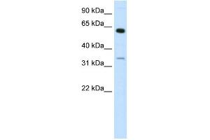 WB Suggested Anti-ZNF609 Antibody Titration: 1. (ZNF609 anticorps  (N-Term))