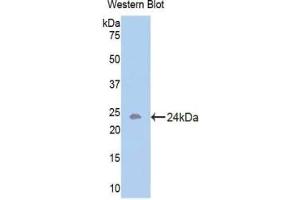 Western blot analysis of the recombinant protein. (Activin A Receptor Type IB/ALK-4 anticorps  (AA 207-385))