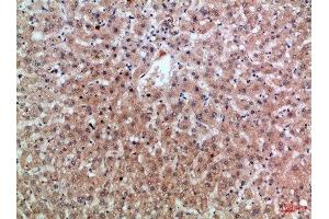 Immunohistochemical analysis of paraffin-embedded Human-liver, antibody was diluted at 1:100