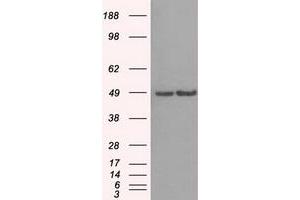 HEK293T cells were transfected with the pCMV6-ENTRY control (Left lane) or pCMV6-ENTRY LEMD3 (Right lane) cDNA for 48 hrs and lysed.