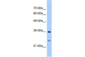 Western Blotting (WB) image for anti-Glutathione Transferase zeta 1 (Maleylacetoacetate Isomerase) (GSTZ1) antibody (ABIN2463253) (GSTZ1 anticorps)