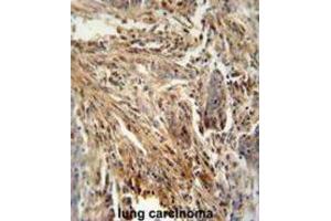 Immunohistochemistry (IHC) image for anti-Colony Stimulating Factor 2 (Granulocyte-Macrophage) (CSF2) antibody (ABIN2995782) (GM-CSF anticorps)