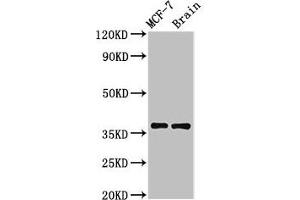 Western Blot Positive WB detected in: MCF-7 whole cell lysate, Rat brain tissue All lanes: MENT antibody at 3. (MENT (AA 24-197) anticorps)