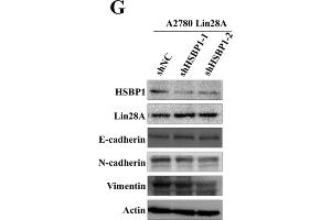 Lin28A promoted the proliferation and invasion of OC cells by up-regulating HSBP1. (beta Actin anticorps)