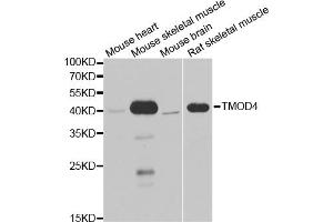 Western blot analysis of extracts of various cell lines, using TMOD4 antibody (ABIN5974100) at 1/1000 dilution. (Tropomodulin 4 anticorps)