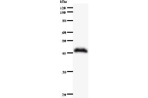 Western Blotting (WB) image for anti-SWI/SNF Related, Matrix Associated, Actin Dependent Regulator of Chromatin, Subfamily A, Member 4 (SMARCA4) antibody (ABIN930944) (SMARCA4 anticorps)