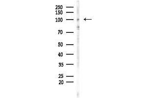anti-Smoothelin (SMTN) (C-Term) antibody