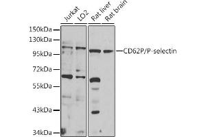 Western blot analysis of extracts of various cell lines, using CD62P/P-selectin antibody (ABIN6131514, ABIN6147503, ABIN6147506 and ABIN6218519) at 1:1000 dilution. (P-Selectin anticorps  (AA 30-200))