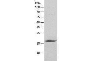 Western Blotting (WB) image for BCL2-Like 2 (BCL2L2) (AA 1-172) protein (His tag) (ABIN7121987) (BCL2L2 Protein (AA 1-172) (His tag))