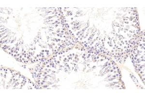 Detection of AXL in Rat Testis Tissue using Polyclonal Antibody to AXL Receptor Tyrosine Kinase (AXL) (AXL anticorps  (AA 21-202))