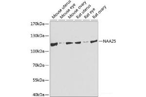 Western blot analysis of extracts of various cell lines using NAA25 Polyclonal Antibody at dilution of 1:1000. (NAA25 anticorps)