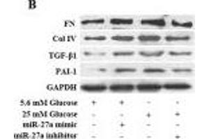 Downregulation of miR-27a with a miR-27a inhibitor prevented high glucose (HG)-induced mesangial cell (MC) proliferation and the expression of ECM-associated profibrotic genes via upregulation of PPARγ expression.