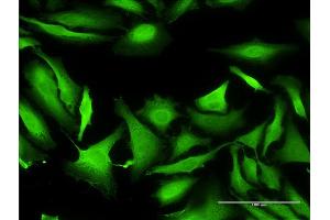 Immunofluorescence of monoclonal antibody to SEPT1 on HeLa cell. (Septin 1 anticorps  (AA 1-367))