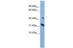 WB Suggested Anti-RHO Antibody Titration: 0. (Rho-related GTP-binding protein anticorps  (C-Term))