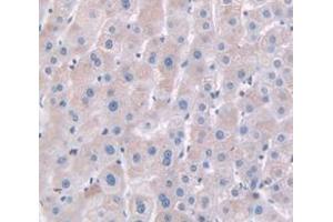 IHC-P analysis of Human Tissue, with DAB staining. (HPR anticorps  (AA 102-347))