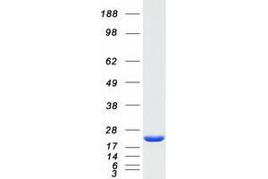 Validation with Western Blot