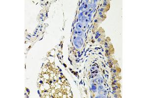 Immunohistochemistry of paraffin-embedded mouse lung using SDC2 antibody (ABIN3022587, ABIN3022588, ABIN3022589 and ABIN6218928) at dilution of 1:100 (40x lens). (Syndecan 2 anticorps  (AA 19-144))