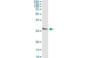 Immunoprecipitation of TWIST1 transfected lysate using anti-TWIST1 monoclonal antibody and Protein A Magnetic Bead , and immunoblotted with TWIST1 MaxPab rabbit polyclonal antibody.