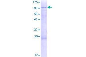 Image no. 1 for Parafibromin (CDC73) (AA 1-531) protein (GST tag) (ABIN1348869)