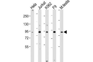 All lanes : Anti-NUP93 Antibody (N-Term) at 1:2000 dilution Lane 1: Hela whole cell lysate Lane 2: Jurkat whole cell lysate Lane 3: K562 whole cell lysate Lane 4: F9 whole cell lysate Lane 5: Mouse testis lysate Lysates/proteins at 20 μg per lane. (NUP93 anticorps  (AA 20-54))