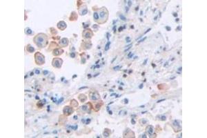 IHC-P analysis of Human Tissue, with DAB staining. (TCN2 anticorps  (AA 19-427))
