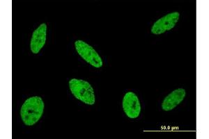 Immunofluorescence of monoclonal antibody to CDKL1 on HeLa cell.