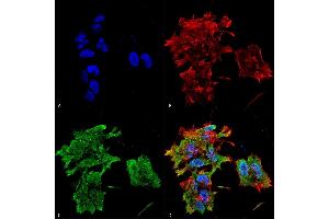 Immunocytochemistry/Immunofluorescence analysis using Mouse Anti-Alpha B Crystallin Monoclonal Antibody, Clone 3A10.