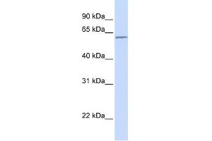 Carboxylesterase 7 antibody used at 1 ug/ml to detect target protein. (CES5A anticorps  (N-Term))