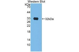 Western blot analysis of the recombinant protein. (Kallikrein 9 anticorps  (AA 1-250))
