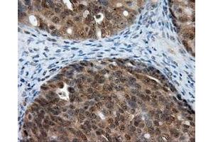 Immunohistochemical staining of paraffin-embedded Kidney tissue using anti-LIPG mouse monoclonal antibody. (LIPG anticorps)
