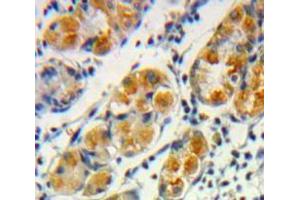 Used in DAB staining on fromalin fixed paraffin-embedded Stomach tissue (Frataxin anticorps  (AA 57-198))