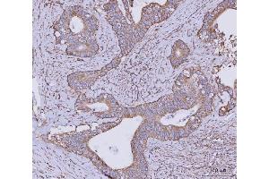 IHC analysis of CLASP1 using anti-CLASP1 antibody (ABIN7599144). (CLASP1 anticorps  (AA 1-243))