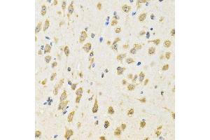 Immunohistochemistry of paraffin-embedded mouse brain using PTPRE antibody.