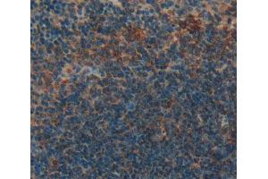 IHC-P analysis of Kidney tissue, with DAB staining. (GRPR anticorps  (AA 1-116))