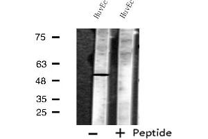 Western blot analysis of extracts from HuvEc cells, using MKNK1 antibody. (MKNK1 anticorps  (Internal Region))