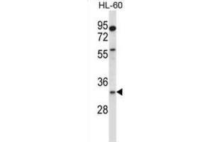 Western Blotting (WB) image for anti-Egl-9 Family Hypoxia Inducible Factor 3 (EGLN3) antibody (ABIN2997822) (EGLN3 anticorps)