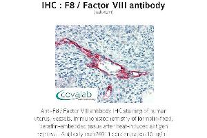 Image no. 1 for anti-Coagulation Factor VIII (F8) antibody (ABIN1723234) (Factor VIII anticorps)
