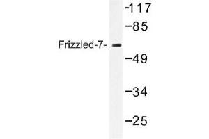 Image no. 1 for anti-Frizzled Family Receptor 7 (FZD7) antibody (ABIN317734) (FZD7 anticorps)