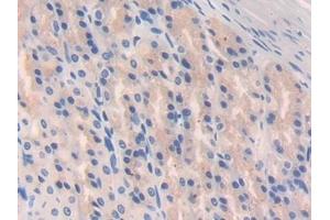 Detection of GAD2 in Rat Stomach Tissue using Polyclonal Antibody to Glutamate Decarboxylase 2 (GAD2)