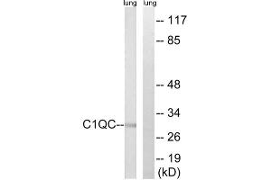 Western blot analysis of extracts from rat lung cells, using C1QC antibody. (C1QC anticorps  (Internal Region))