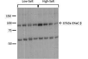 Western blot analysis of Mouse kidney cortex showing detection of ENaC protein using Rabbit Anti-ENaC Polyclonal Antibody .