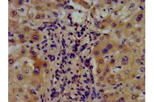 IHC image of ABIN7144688 diluted at 1:400 and staining in paraffin-embedded human liver tissue performed on a Leica BondTM system. (Arylsulfatase E anticorps  (AA 352-494))
