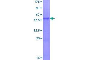 Image no. 1 for NADH Dehydrogenase (Ubiquinone) Fe-S Protein 8, 23kDa (NADH-Coenzyme Q Reductase) (NDUFS8) (AA 1-210) protein (GST tag) (ABIN1312293)