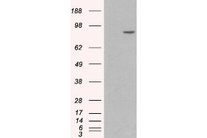 HEK293 overexpressing Human CTNNA1 (RC201766) and probed with ABIN185626 (mock transfection in first lane), tested by Origene. (CTNNA1 anticorps  (Internal Region))