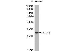 Western blot analysis of extracts of mouse liver, using CACNG4 antibody (ABIN2561527) at 1:1000 dilution.
