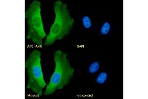 (ABIN5539467) Immunofluorescence analysis of paraformaldehyde fixed HeLa cells, permeabilized with 0.