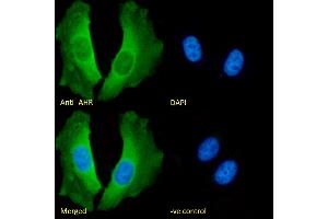 (ABIN5539467) Immunofluorescence analysis of paraformaldehyde fixed HeLa cells, permeabilized with 0. (Aryl Hydrocarbon Receptor anticorps  (Internal Region))