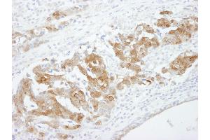 Immunohistochemistry (IHC) image for anti-Cellular Retinoic Acid Binding Protein 2 (CRABP2) (C-Term) antibody (ABIN7448487) (CRABP2 anticorps  (C-Term))