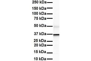 WB Suggested Anti-ZFP36L1 antibody Titration: 1 ug/mL Sample Type: Human liver (ZFP36L1 anticorps  (Middle Region))