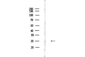 anti-All-Trans Retinoic Acid-Induced Differentiation Factor (ATRAID) (Internal Region) antibody